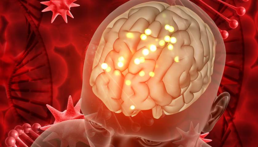 नारनौल में मस्तिष्क धमनीविस्फार उपचार