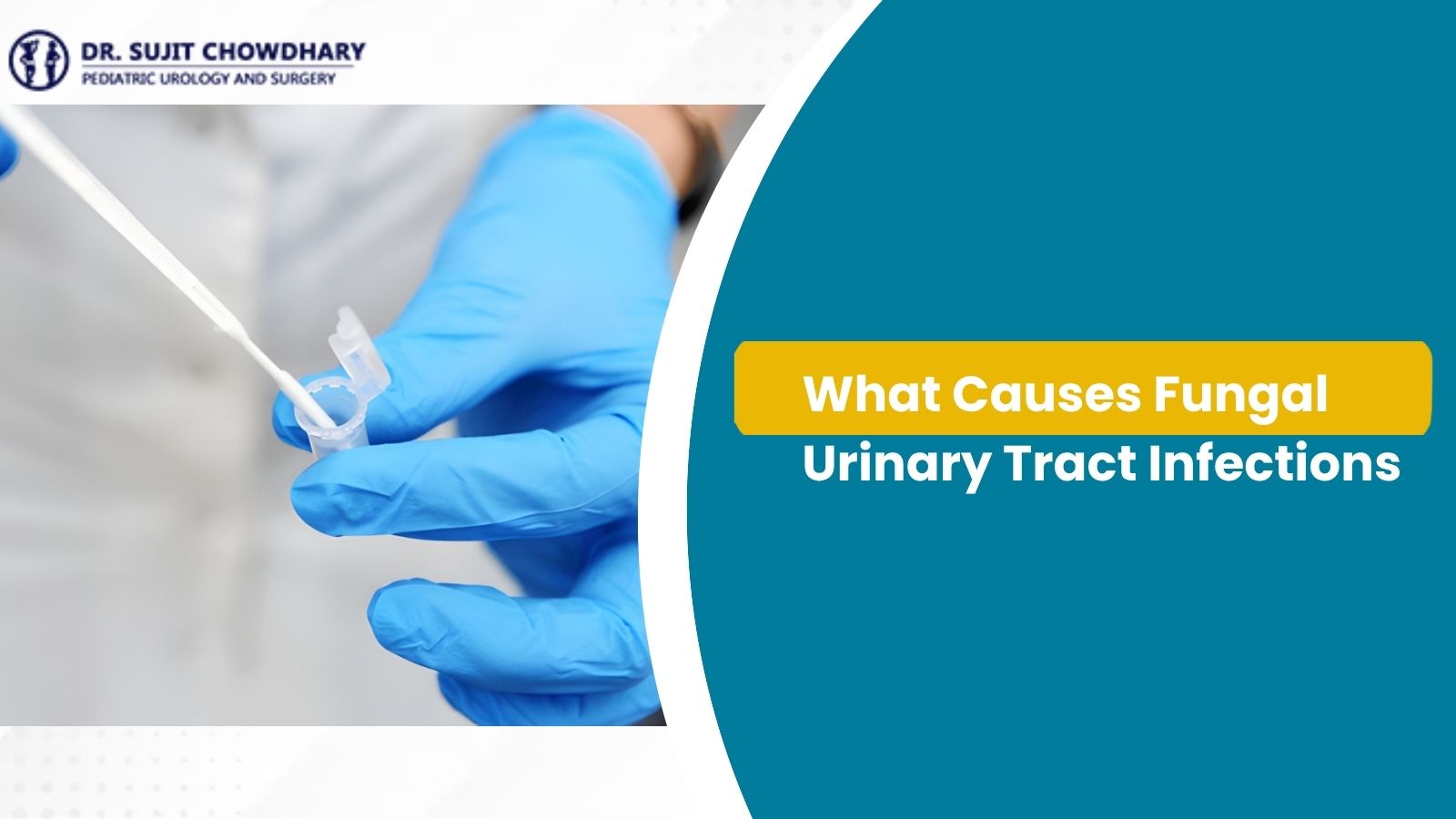 What Causes Fungal Urinary Tract Infections