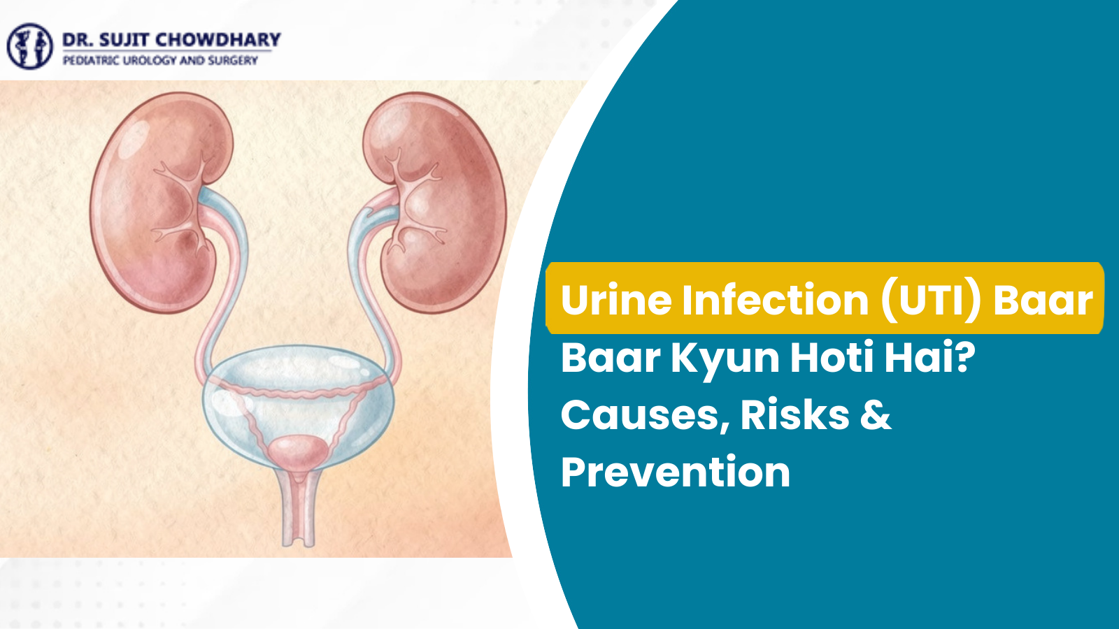 কিডনি এবং মূত্রাশয় দেখাচ্ছে প্রস্রাবের সংক্রমণ (ইউটিআই) চিত্র