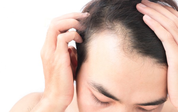 Hair transplant