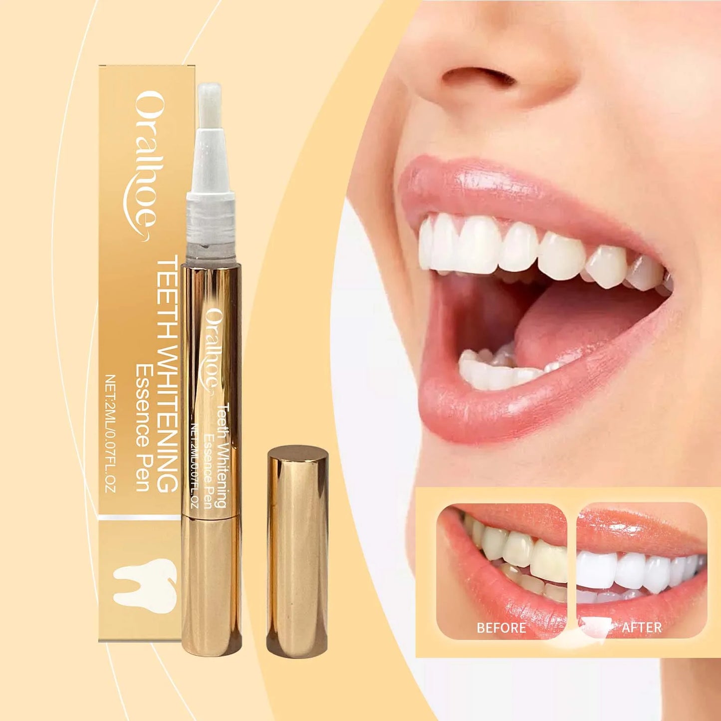 Teeth Whitening, Dental Hygiene, and Fresh