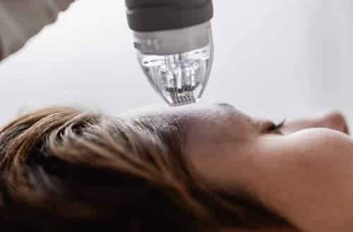 Microneedling Techniques