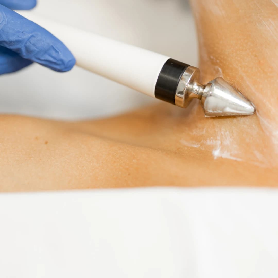 EMS / Microstroom Lichaambehandeling