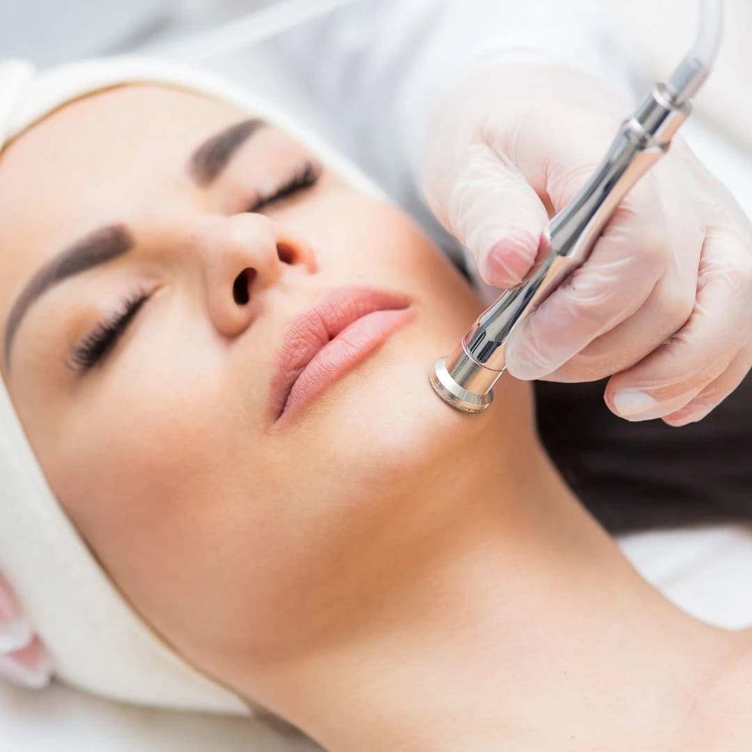 Microdermabrasie Gezichtsbehandelingen