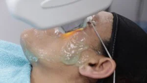 Photofacial