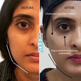 anti_aging2
