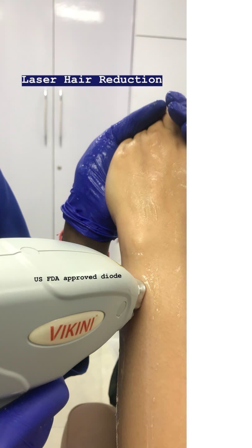 Laser_Hair_Reduction_2 Laser Hair Reduction Procedure